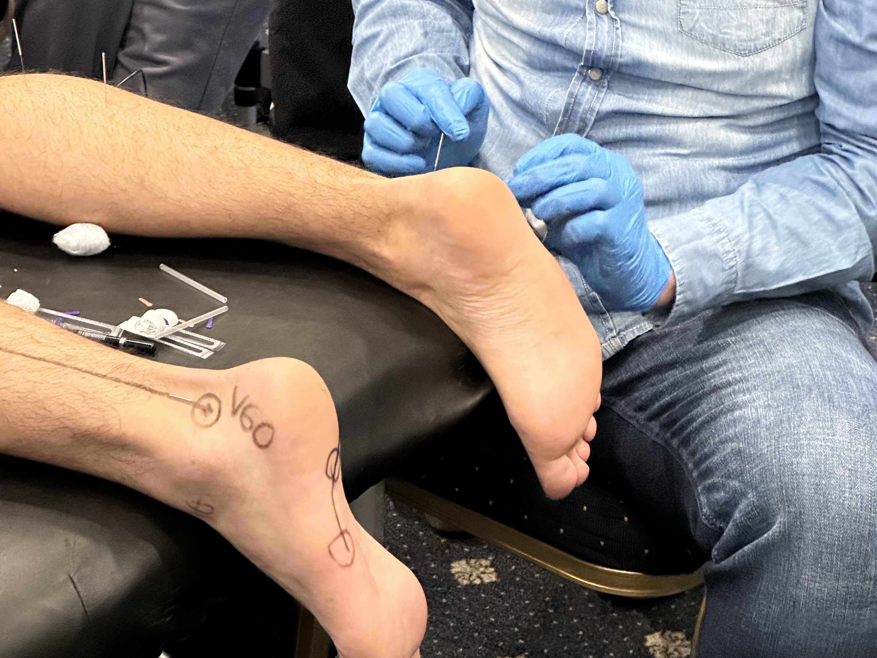 Puntura Neurofuncional em Fisioterapia Invasiva | 5.ª Edição